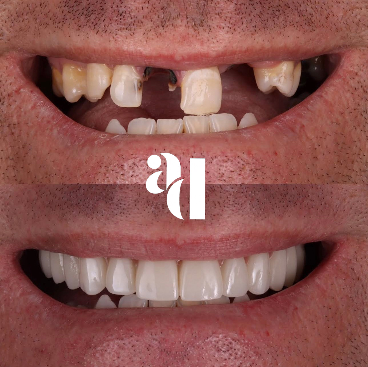 Dental transformation result 5