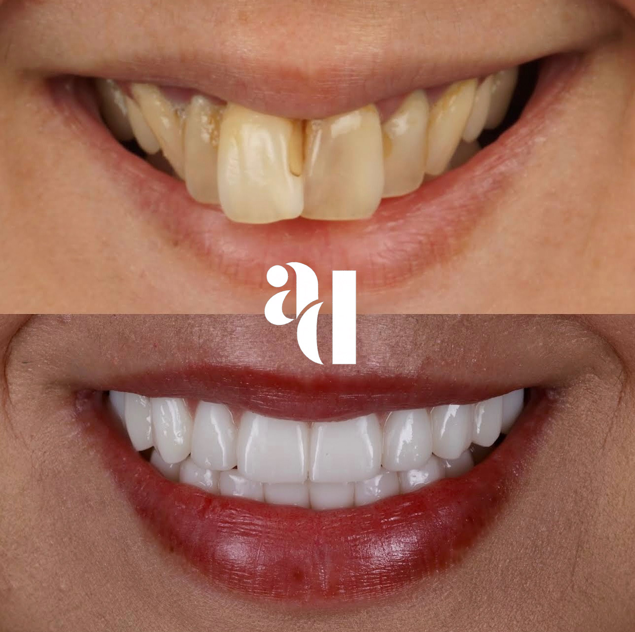 Dental transformation result 4
