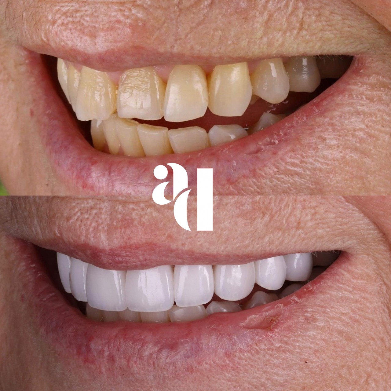 Dental transformation result 6